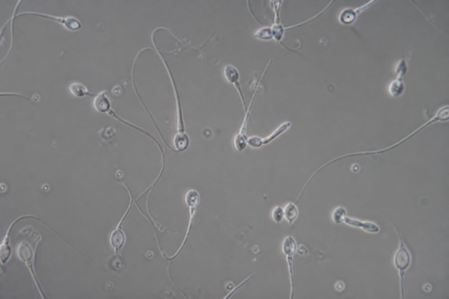 découvrez comment les spermatozoïdes atypiques peuvent influencer la fécondation et leur potentiel rôle surprenant dans la reproduction.