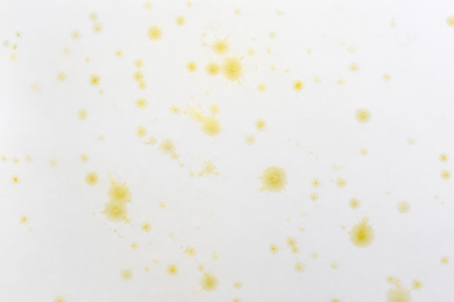 découvrez l'origine et les explications scientifiques derrière les taches jaunes sur fond blanc, un phénomène visuel intrigant qui suscite curiosité et fascination.