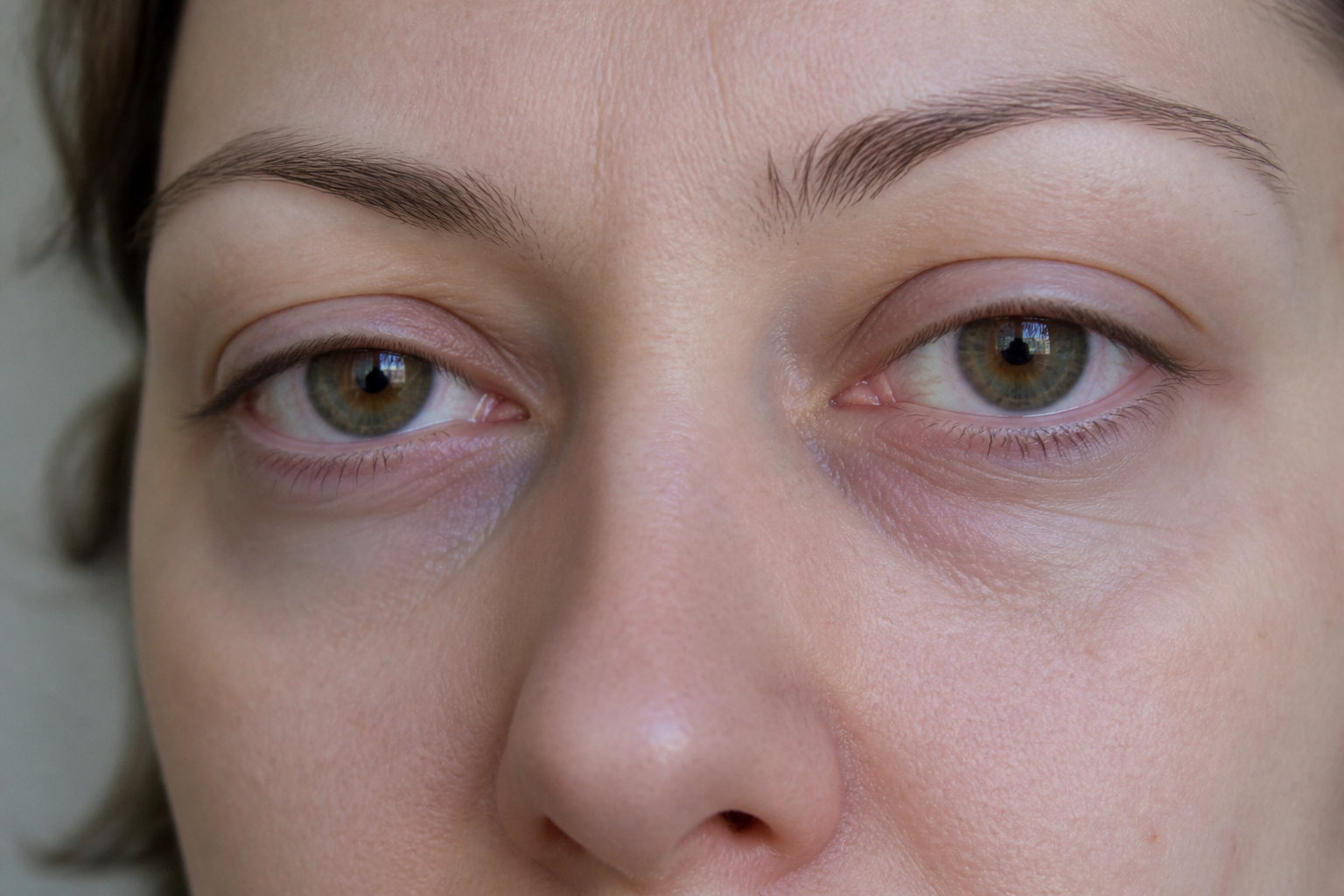 Cernes sous les yeux : causes possibles et gestes utiles
